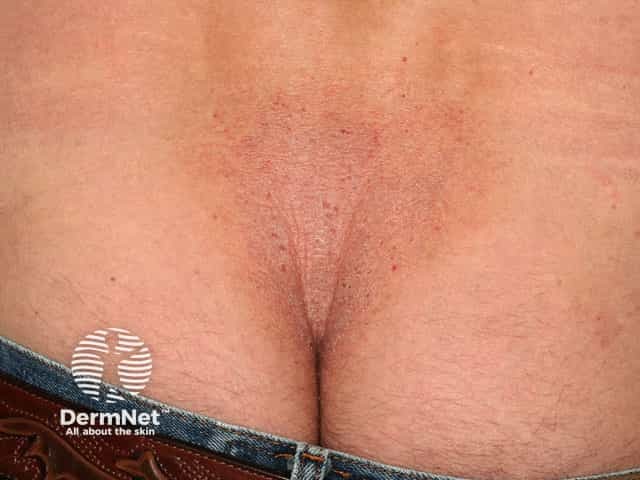 3121
