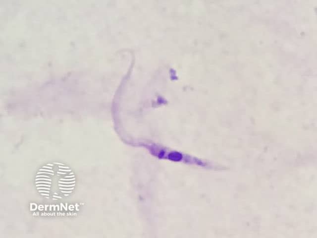 Эпимастигота Trypanosoma cruzi