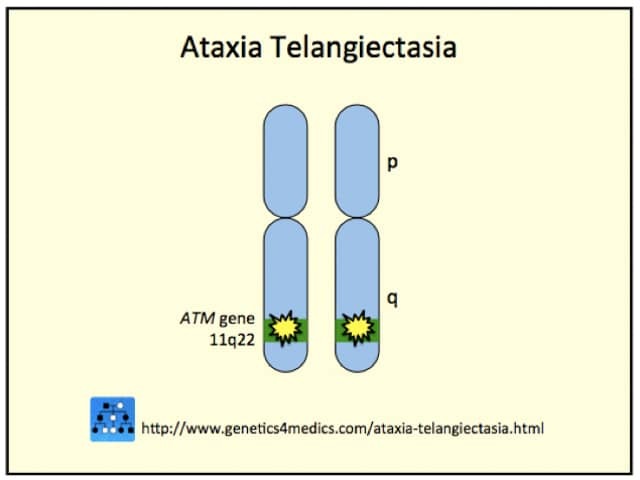 Генетика атаксии-телеангиэктазии*