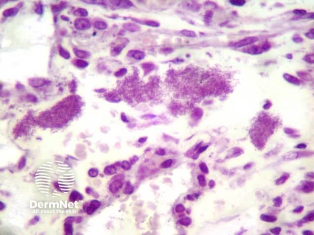 Рисунок 3. Грамотрицательные палочковидные бактерии Bartonella henselae