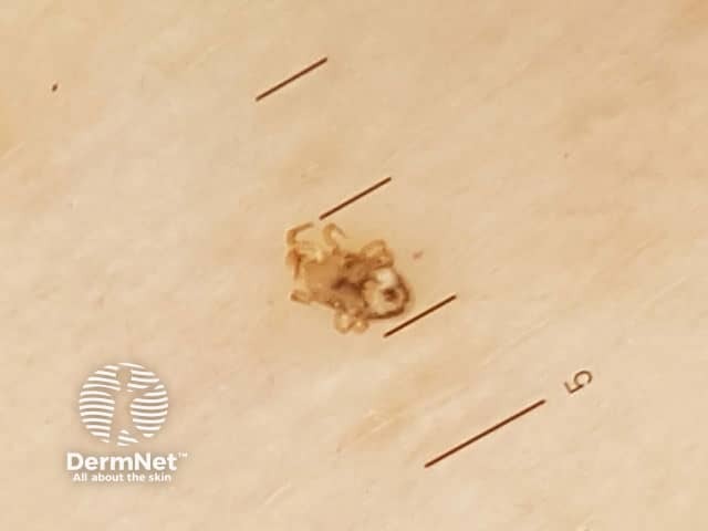 Красный куриный клещ (Dermanyssus gallinae)