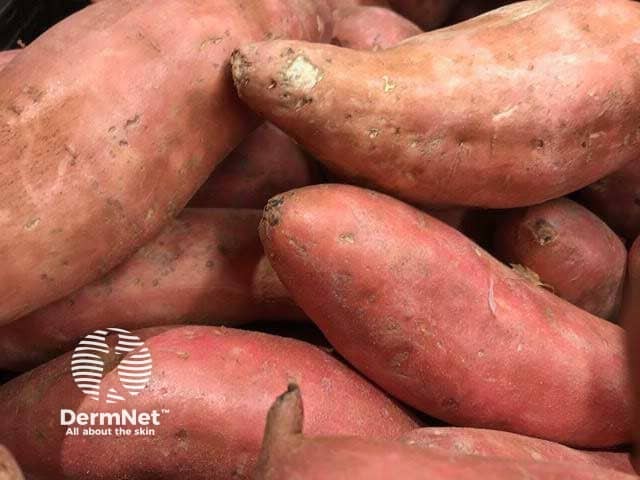 Батат (сладкий картофель)