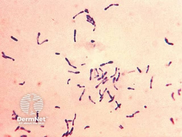 Окраска Corynebacterium diphtheriae по Граму