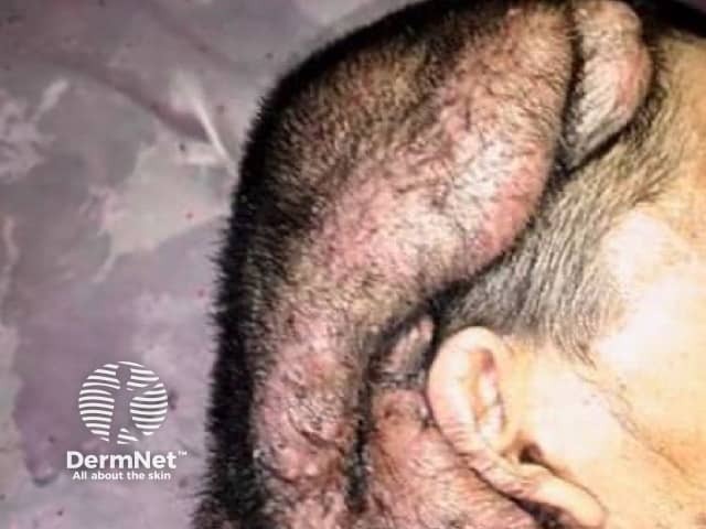 Фото любезно предоставлено д-ром Мохаммадом Махмудом (Mohammad Mahmoud)