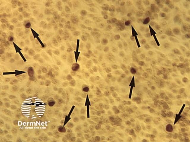 Хламидии (Chlamydia trachomatis), окраска по Романовскому–Гимзе (CDC)