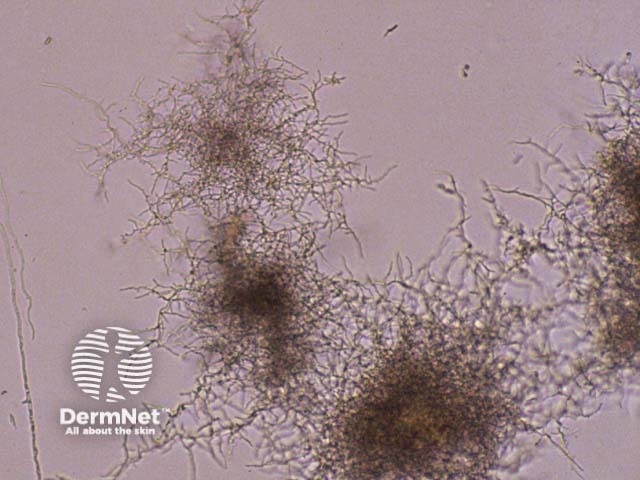 Рост колоний Nocardia на агаре