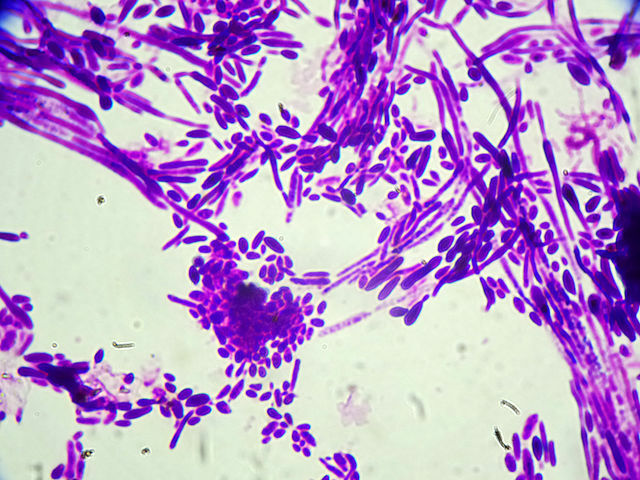 Микроскопия C. dubliniensis