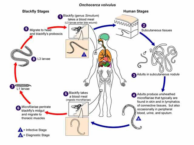 Жизненный цикл возбудителя онхоцеркоза (Onchocerca volvulus)