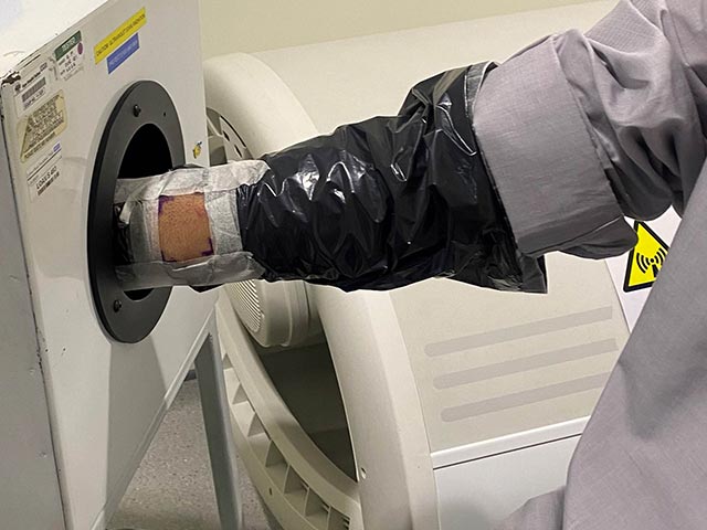Фотопровокационное тестирование ультрафиолетовым излучением
