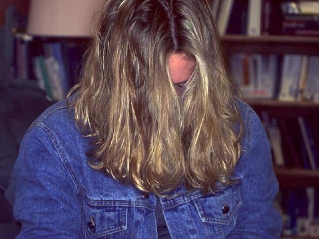 Подросток с вульгарными угрями (акне)