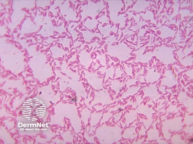 Бактероиды (Bacteroides)