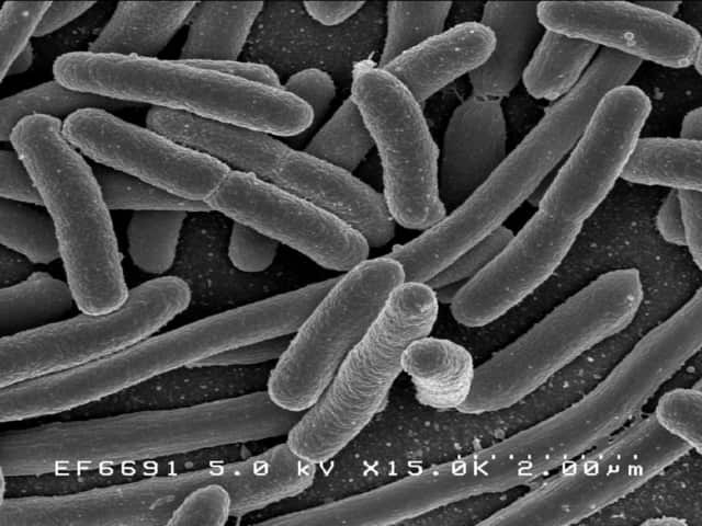 Кишечная палочка (Escherichia coli)