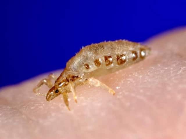 Платяная вошь (Pediculus humanus corporis) — переносчик эпидемического сыпного тифа